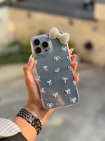 قاب پاپیون لاکچری آیفون و سامسونگ و شیائومی (کدC1935) - تصویر 9