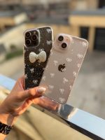 قاب پاپیون لاکچری آیفون و سامسونگ و شیائومی (کدC1935) - تصویر 6